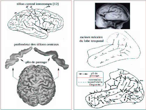 sillons et plis du cortex cérébral