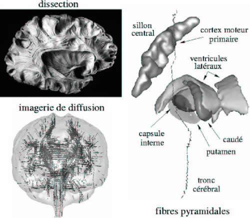 Images de dissection du cerveau