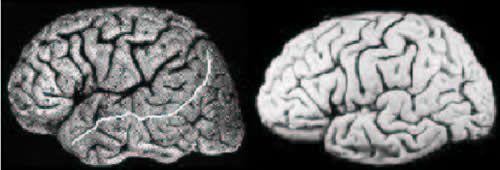 Anatomie du cortex cérébral