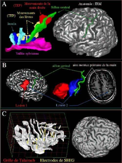 Morphologie du cortex cérébral