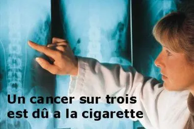 Un cancer sur trois est dû à la cigarette