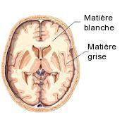 Cerveau : Matière blanche et matière grise